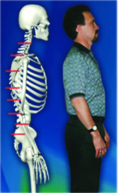 A photograph of a man with a straight back, next to an illustration of a skeleton with vertebra at correct angles.