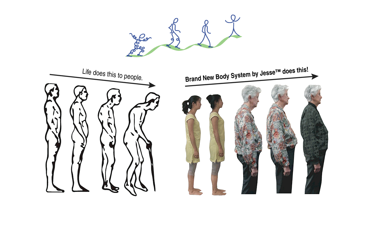 An illustrated person that starts out with good posture and gradually gets more bent and hunched. Real photographs of a young woman and an old woman show hunched posture before and straight posture after treatment.