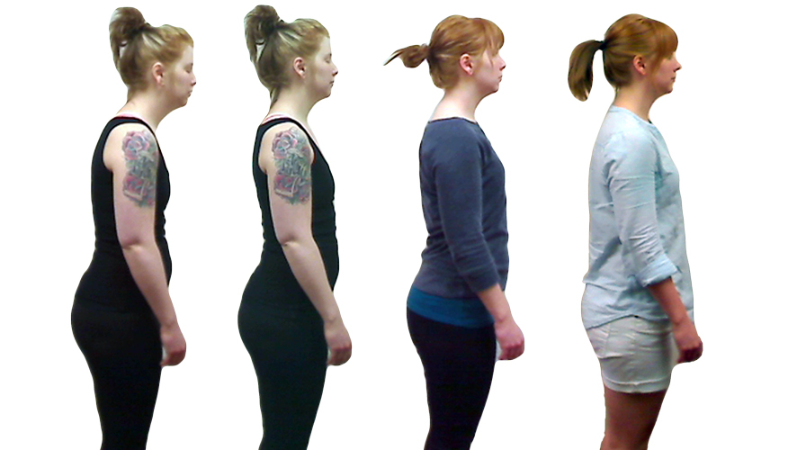 Four side photos of a woman showing the progression from a bent spine and neck to straight posture.